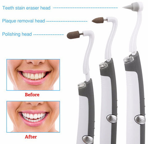 Sonic Tooth Stain Eraser And Plaque Remover